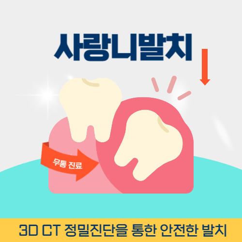 울산치과 울산광역시 치과 사랑니 발치